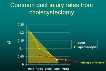Common duct injury rates from cholecystectomy